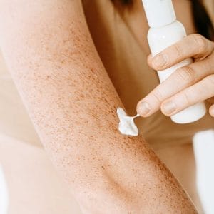 Applying lotion on freckled arm