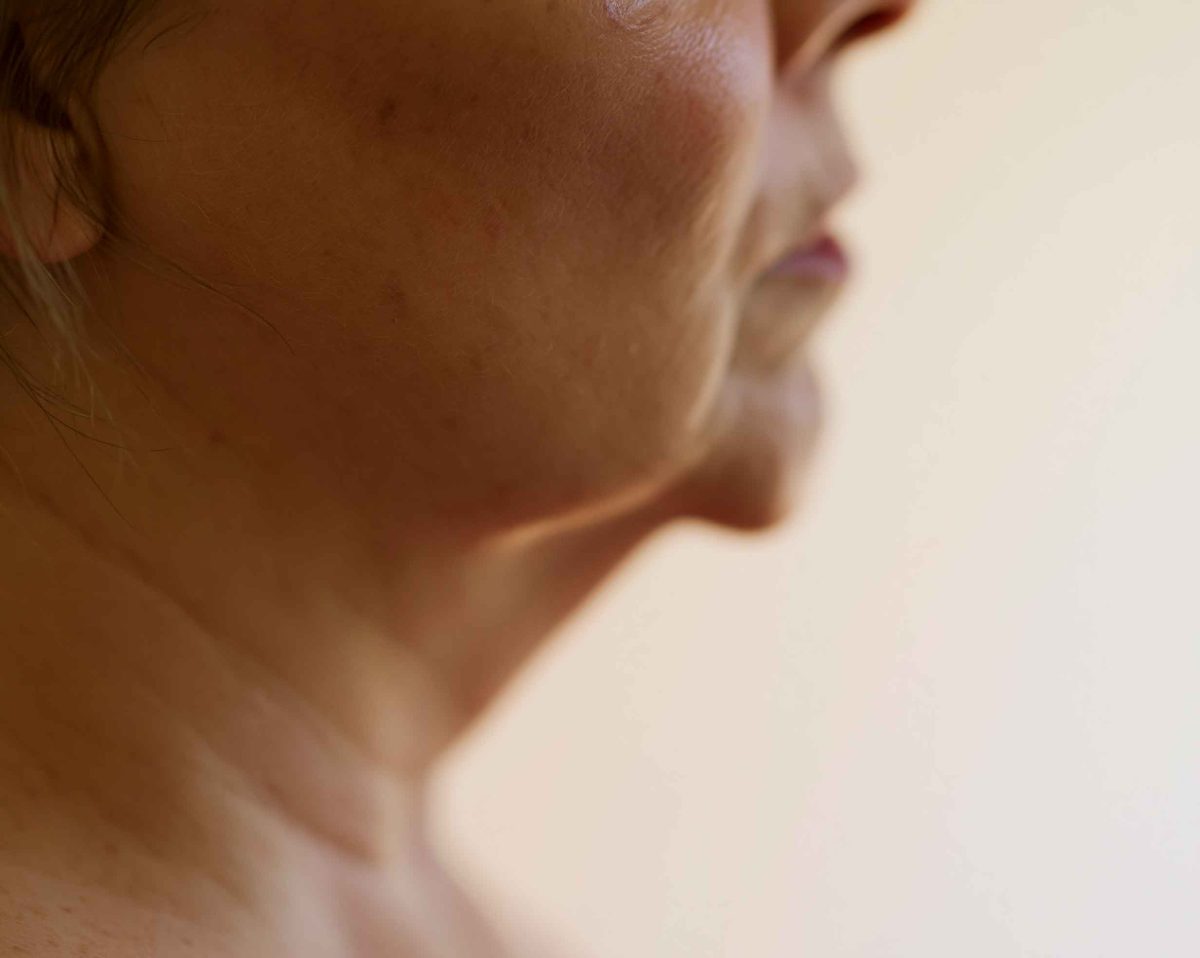 close up of face in profile showing natural jaw dc9117d9 4904 49a9 aa69 7340be09e1b3 3